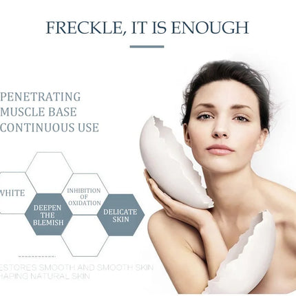 Effective Whitening Freckles Cream Remove Melasma Dark Spots Fade Melanin Pigmentation Moisturizing Brighten Skin Care Products