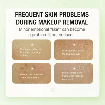 Maffick10pcs/30pcs Cleansing Oil Camellia Sublime Nourishing Moisturizing Deep Pore Cleansing Makeup Removing Oil