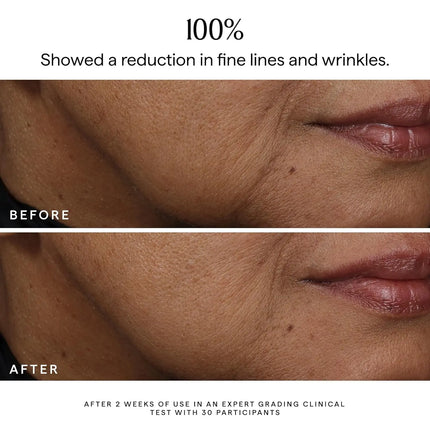 Bakuchiol Facial Rejuvenation Serum Anti Wrinkle Fade Fine Lines Firming Skin Elasticity Improve Radiance Face Hydrating Essence