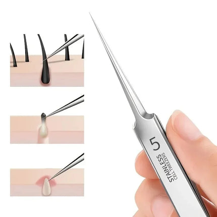New 1/3 Pack Extra Fine No. 5 Cellular Acne Blackhead Tweezers - Facial Beauty Remove Acne Needle Tools for Skin Care Tools