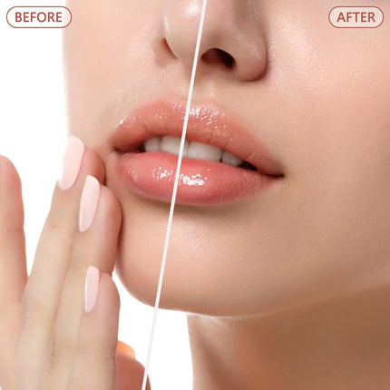 Facial Hair Remover for Women - as Seen on TV Painless Face Shaver - Electric Hair Removal Device for Face Lips Peach Fuzz