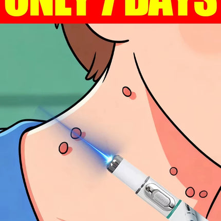 Bolígrafo de luz azul para resolver verrugas en el cuello, herramientas para el cuidado de verrugas/g*53