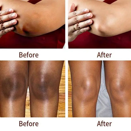 Fast Whitening Dark Knuckles Brighten Hand Cream Melanin Corrector Moisturizing Intense Stains Remover Products Korean Skin Care