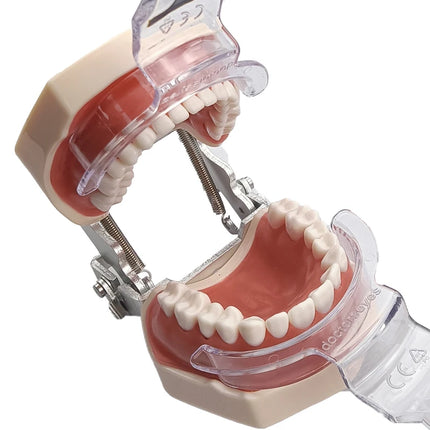 Dental Mouths Openers Lip Retractor Intraoral Cheek Upper Lower Lip Retractor Orthodontic Dentist Tools