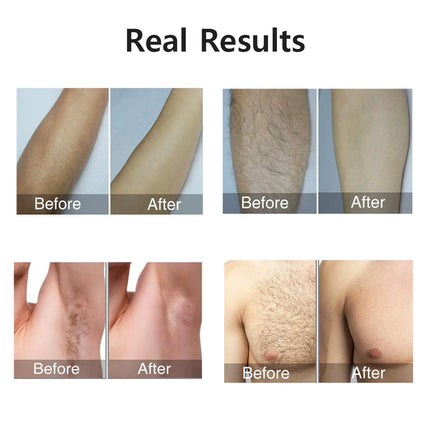 999999 Flashes Laser Epilator for Women Men Body Bikini Legs Arms Armpit Hair Removal Painless IPL Laser Permanent Depilator