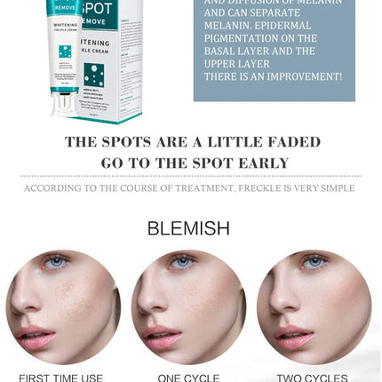 Effective Whitening Freckles Cream Remove Melasma Dark Spots Fade Melanin Pigmentation Moisturizing Brighten Skin Care Products