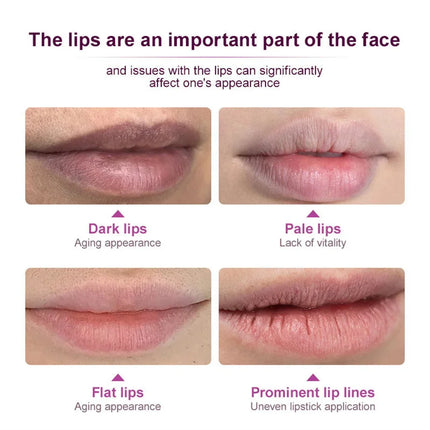 Remove Dark Lip Balm Fast Lightening Pink Lip Exfoliating Fade Lip Line Dead Skin Moisturizer Korean Care Products Beauty Health