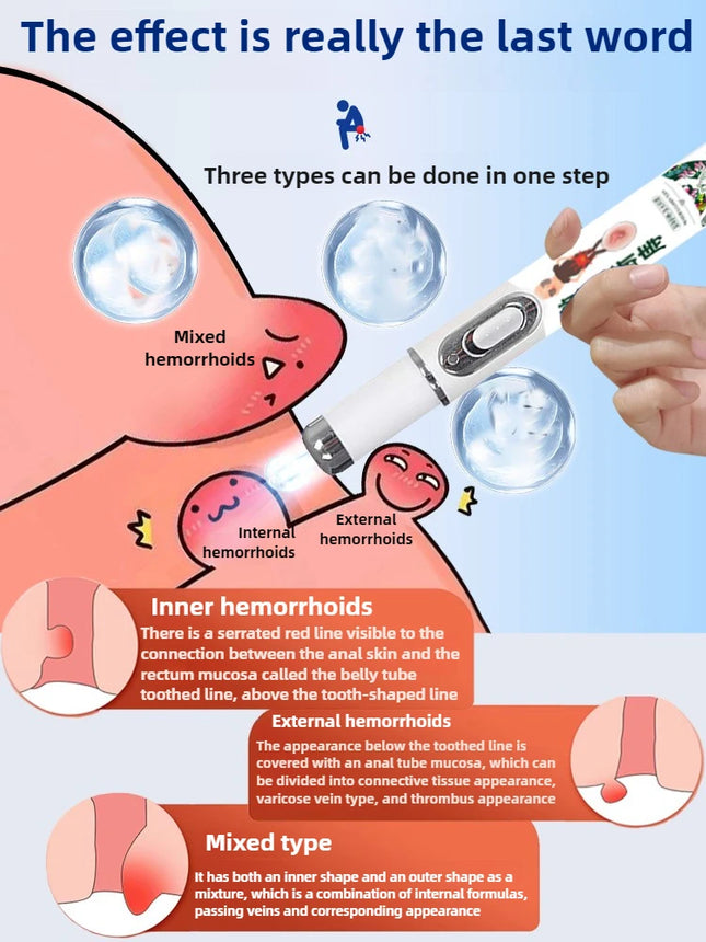 Enhanced Hemorrhoids Treatment Eliminates Internal External Hemorrhoids Lumps Fast Relief