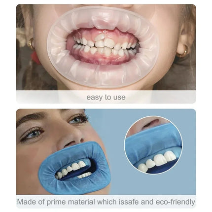 JUMTOP 10Pcs Dental O Shape Disposable Rubber Dam Sterile Mouth Opener Lip Cheek Retractors Dentistry Materials