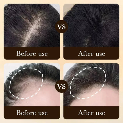 20ml Anti Hair Loss Effective Grow Thicker Hair Biotin Fast Hair Growth Oil Products Care Scalp Massage Treatments  For Men