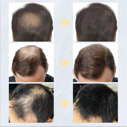 27.5gHair Fiber for Thinning Hair Instant Thickening Hair Building Fibers for Men Women Cover Bald Spots Hairline Gaps Hair care