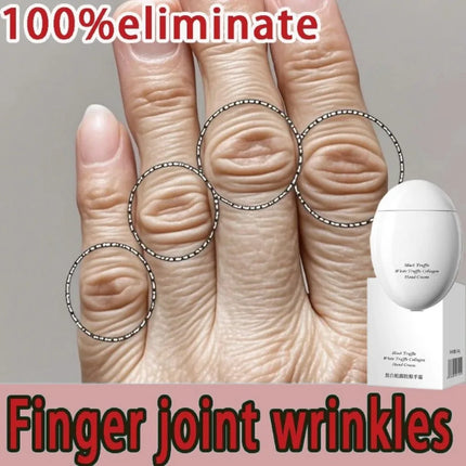 Hand cream for removing wrinkles on finger joints, removing hand wrinkles, and reducing joint roughness and blackness