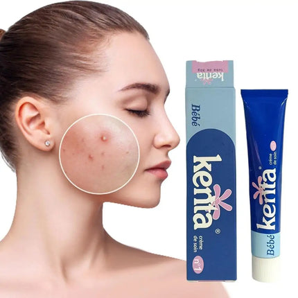 Original Brand Body Face Cream Fade Acne Blemish Whitening Moisturizer 1/3/5pcs Vitamin E Soothes Redness Kenta Moroccan Cream