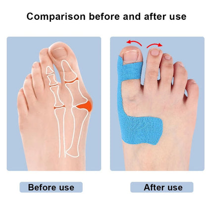 10PCS Precut Kinesiology Tape for Bunion,Bunion Corrector & Relief,Big Toe Support Pain Relief,Hypoallergenic Latex-Free Tape