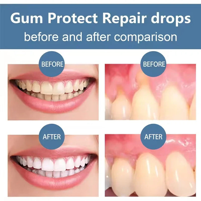 Damaged Gum Repair Care Gel, Gum Pain Sensitivity Relief, Deep Cleaning Teeth Stain Tartar Remover, Anti-Cavity Daily Oral Care Gel