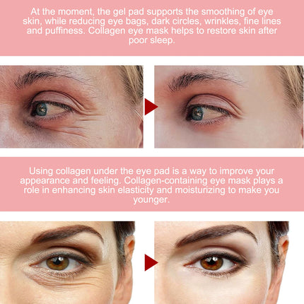 Pink Rose Eye Mask - Anti-Wrinkle & Dark Circle Treatment, Hydrating Under Eye Patches, Firming & Brightening Eye Care
