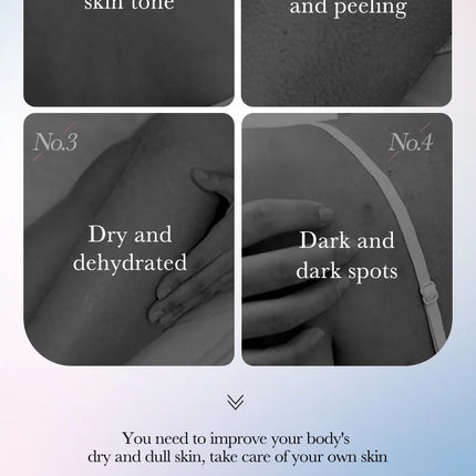 Body Whitening Cream Dark Skin Armpit Lightening Intimate Areas Underarm Bleaching Private Parts Whiten Cream Body Lotion Beauty