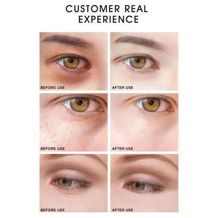 Eye Serum Roller Massager & Gold Eye Cream Eye Care 2pcs/set Dark Circles Fade Puffiness Moisturizing