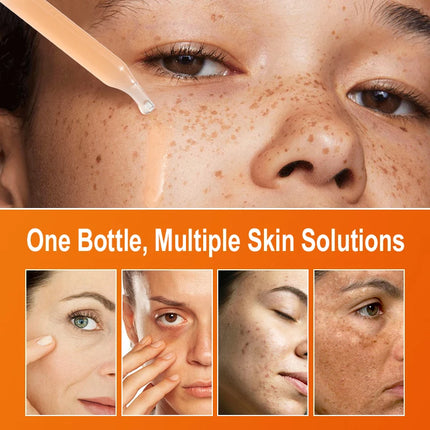 Vitamin C Face Serum Whitening Dark Spot Removal Hyaluronic Acid Facial Essence Skin Care Products 30ML