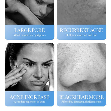 Salicylic Acid Face Cream Acne Creams Mark Repair Firming Moisturizing Blackhead Remover skincare Facial Cream