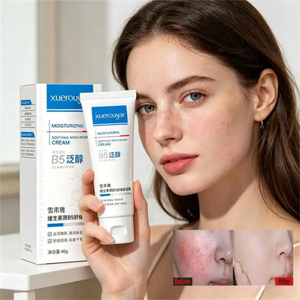 B5 Faded Facial Redness Cream Instant Spider Vein Remove Sensitive Skin Sooth Anti Redness Rosacea Treat Lotion Korean Cosmetic
