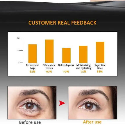 Eye Serum Roller Massager & Gold Eye Cream Eye Care 2pcs/set Dark Circles Fade Puffiness Moisturizing