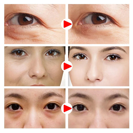 Moisturizing Collagen Eye Mask Patch Wrinkle Remove Eyes Patches Hydrating Firming Lifting Fade Fine Lines Eyes Skin Care Masks