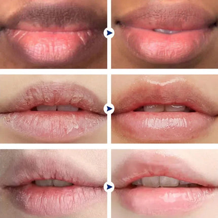 Remove Dark Lip Balm Lightening Melanin Mask Gloss Oil Exfoliating Clean Deep Moisturizing Makeup Beauty Health Korean Products