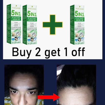 Secrets to a Youthful Appearance Qᵘⁱᶜᵏˡʸ Rᵉᵐᵒᵛᵉ Wʳⁱⁿᵏˡᵉˢ