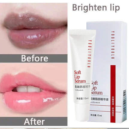 15g Remove Dark Lip Balm Lip Essence Cream Lighten Lip Lines Whitening Moisturizing Brightening Serum Lip Care Product Women Men