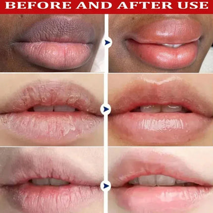 Remove Dark Lip Balm Lighten Melanin Lip Mask Fade Lip Line Brighten Exfoliating Moisturize Dead Skin Repair Lip Care Products