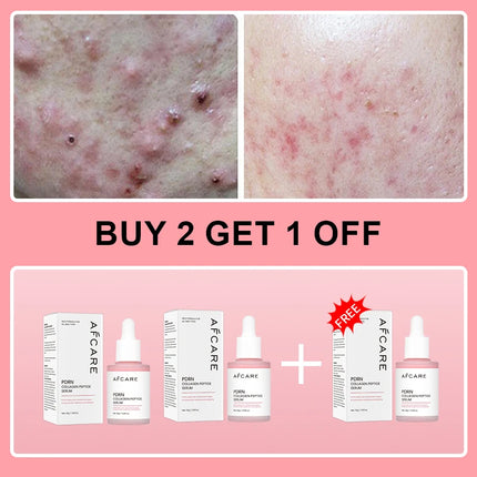 Complex Peptide Acne Serum PDRN Collagen Shrink Pores Fade Melanin Smooth Brightening Skin Korean Skincare Products