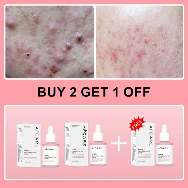 Collagen Peptide Facial Serum Targets Dull Skin Boosts Skin Elasticity Stimulates Skin Renewal Repairs Salmon PDRN KOREAN Product