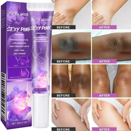 Nicotinamide Brightening Cream For Dark Skin Effective Lighten Thigh Inner Bleach Remove Melanin Private Parts Brighten Cream