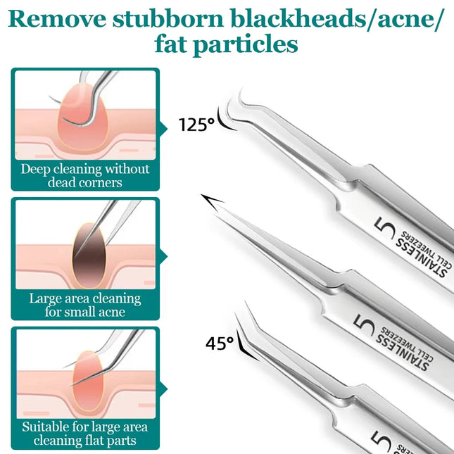 Ultra-fine No.5 cell blackhead and acne tweezers for facial beauty a special needle tool for women to remove blackheads and acne