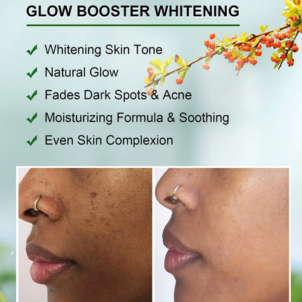 WK JALY Dark Spot Corrector Cream, Lightening Skin, Remove Melanin, Freckles, With Niacinamide, Kojic Acid, For Face And Body