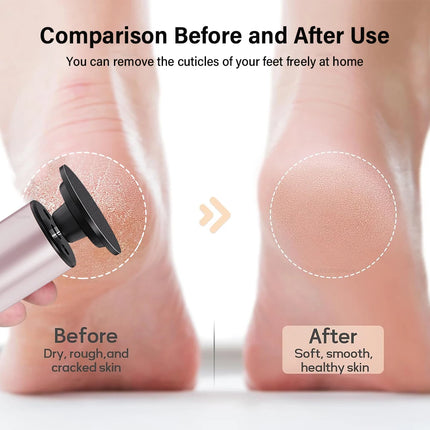 Callus Remover / Lime Pieds