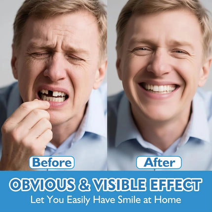 Moldable Silicone False Teeth for Men & Women, Upper Lower Set Fix Smile Fast, Free Denture Toothpaste & Toothbrush Included