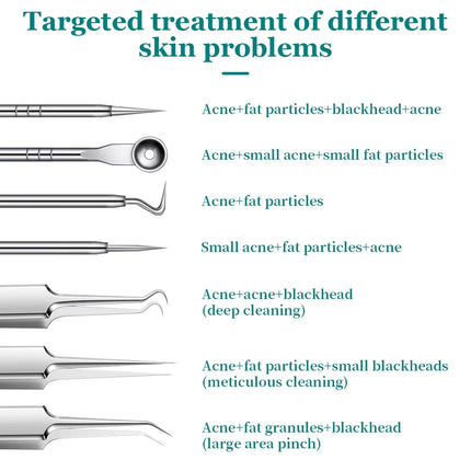 Ultra-fine No.5 cell blackhead and acne tweezers for facial beauty a special needle tool for women to remove blackheads and acne