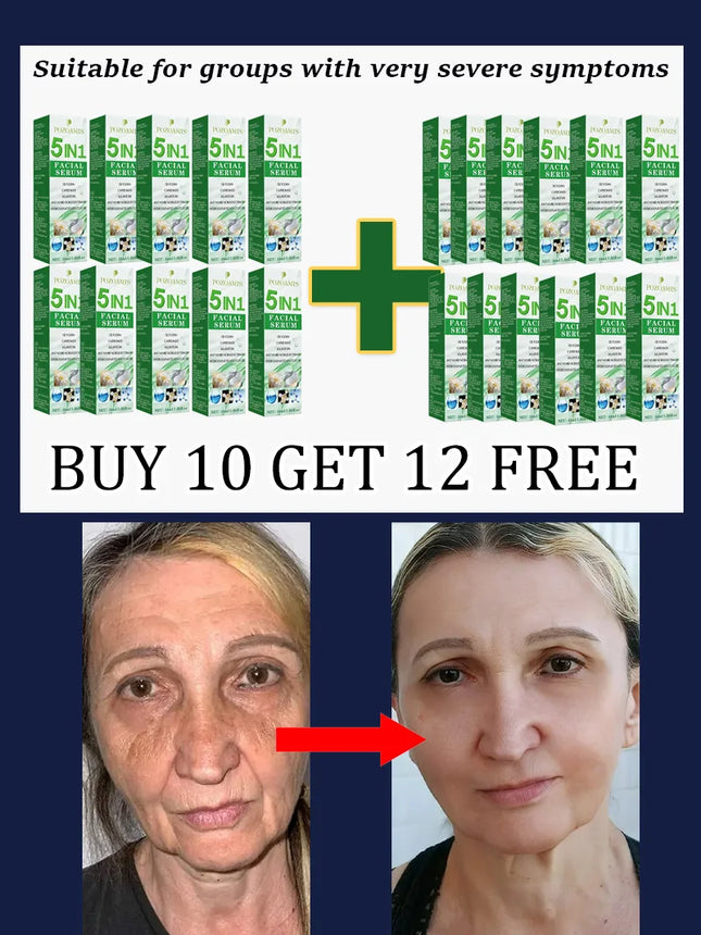 Secrets to a Youthful Appearance Quickly Remove Wrinkles