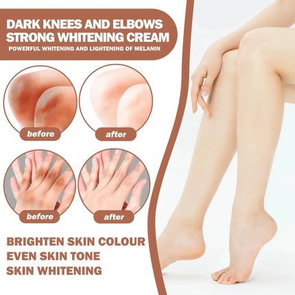 Dark Knuckles Fast Brighten Cream Elbows Hand Knuckle Brightening Serum Knee Black Skin Quickly Lighten Stains Remover Products
