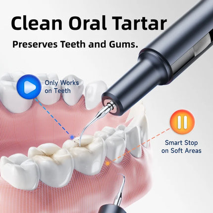 CURVY MOON T7 Portable Electric Sonic Dental Calculus Scaler Oral Teeth Tartar Remover Plaque Tooth Stone Stains Cleaner Removal