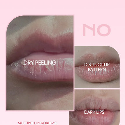 4/6/8pcs Fruit Series Lip Balm Set Sleeping Lip Mask Moisturizing Hydrating Non-sticky Anti-Cracked Lip Balm Lips Care
