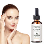 30ML