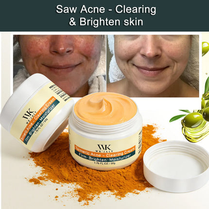 WK JALY Acne Clearing Brighten Turmeric Face Cream, Remove Spots, Pigmentation, Improve Dull Skin, With Niacinamide, Aloe Vera