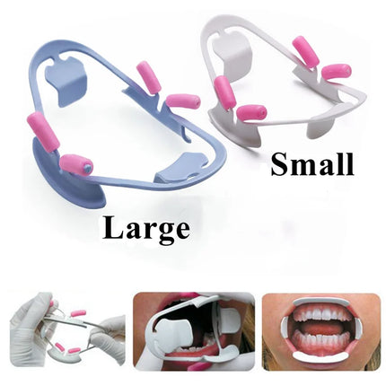 Dental Mouth Opener 3D Oral Lip Cheek Retractor O Shape Orthodontics Tools Dentistry Mouth Gag Lip Retractor Dentists Supplies