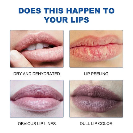 Remove Dark Lip Balm Lighten Melanin Lip Mask Fade Lip Line Brighten Exfoliating Moisturize Dead Skin Repair Lip Care Products