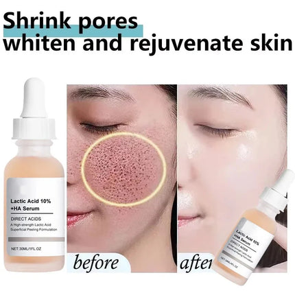 Remove Large Pores Serum Lactic Acid Facial Pore Shrinking Repairing Products Pore Minimizing Firming Smooth Korean Skin Care