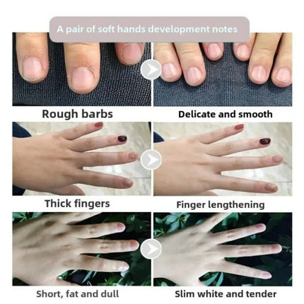 Hand cream for removing wrinkles on finger joints, removing hand wrinkles, and reducing joint roughness and blackness