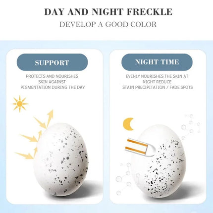 Effective Whitening Freckles Cream Remove Melasma Dark Spots Fade Melanin Pigmentation Moisturizing Brighten Skin Care Products